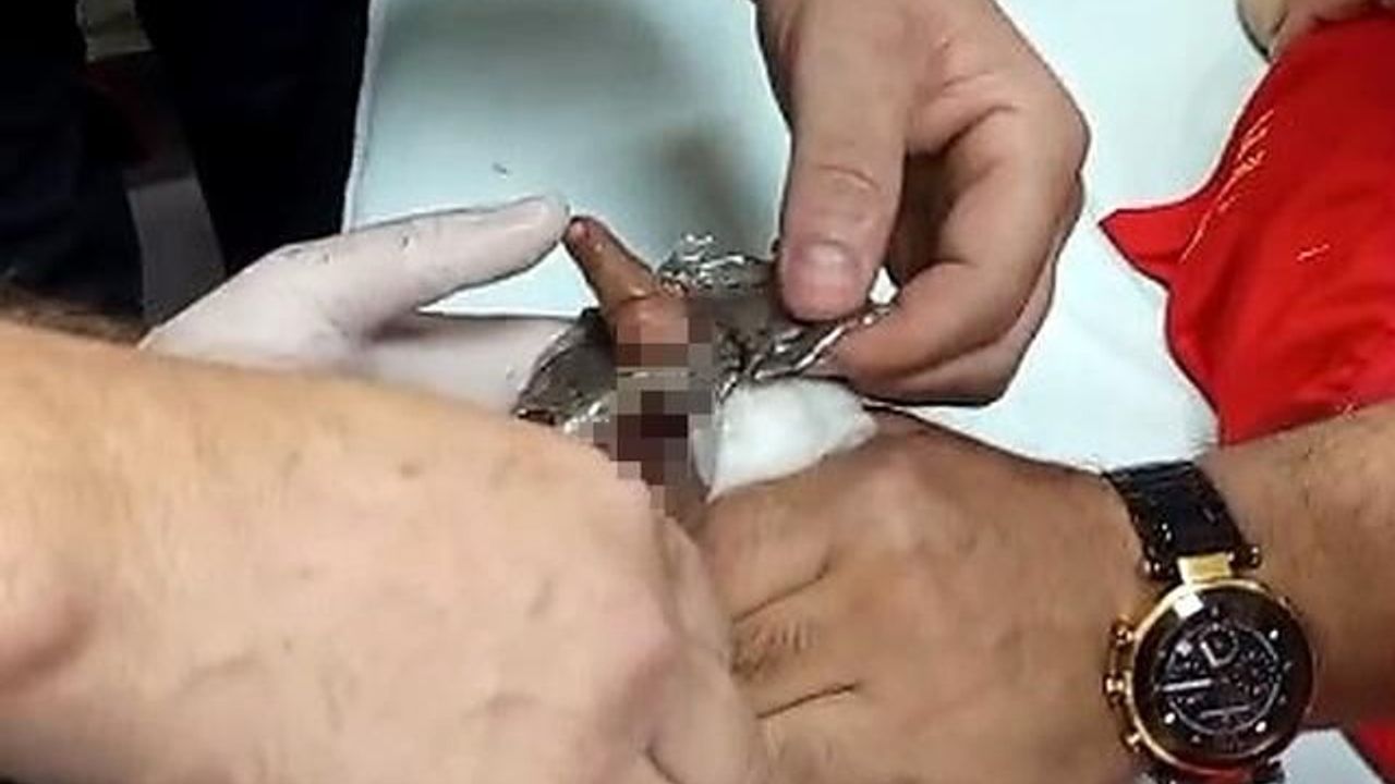 Bitlis'te parmağı çelik halkaya sıkışan çocuk itfaiye ekiplerince kurtarıldı