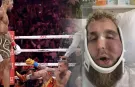 Joshua’dan Feci Nakavt: Jake Paul’un Çenesi Kırıldı