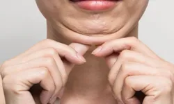 Keşanlı 3 dermatolog, Tiflis’teki Dermavizyon toplantısında buluştu