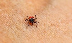 Kenelerden koruyan etkili kalkan! O formüllerle keneleri vücudunuzdan uzaklaştırın