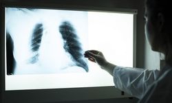 Sigara içmeyenlerde akciğer kanseri yükselişte