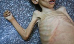 Katliam kahkahası! İsrail Gazze'de kıtlığı dayatıyor! 27 yaşında 15 kiloyken can verdi!