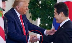 Dünya Trump'ın elindeki morluğu konuşuyor: Beyaz Saray'dan açıklama geldi!