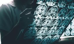 Harvard’dan çığır açan buluş: Alzheimer’a karşı lityum umudu