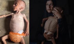 İsrail'in açlık silahı... Gazze'de 40 binden fazla bebek ölüm riskiyle karşı karşıya