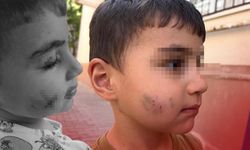 Uyurken dehşeti yaşadı: Lağım faresi ısıran çocuğa kuduz aşısı yapıldı!