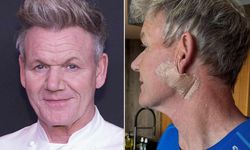 Gordon Ramsay kansere yakalandı