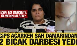 Cips paketini açarken boğazını kesti! Ayrıldığı eşi dehşeti yaşattı: Ölmedin mi sen?