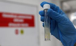 DSÖ açıkladı... Dünyanın en ölümcül bulaşıcı hastalığı oldu! 2024'te 1,23 milyon can aldı