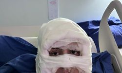 Kadıköy'de akıl almaz olay: Genç kadın başka bir kadın tarafından ateşe verildi