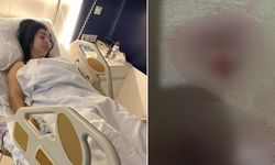 Yağ aldırma ameliyatı kabusa döndü: Ses sanatçısı hastane ile mahkemelik oldu