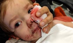 Ankara'da iki kardeşe saldıran pitbull ve sahibi yakalandı