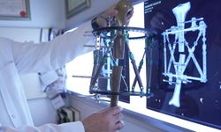 Boy kısalığında çığır açan tedavi: Günde 1 milimetre uzatan yöntem