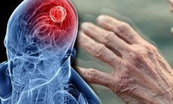 Parkinson Hastalığında Kök Hücre Umudu: İlk Sonuçlar Olumlu