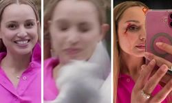 Muhabirin zor anları! Yüzüne kuş çarptı