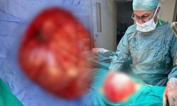 14 Yaşındaki Öğrencinin Karnından 3,5 Kiloluk Kist Çıkarıldı
