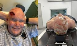 6 Ay Ömür Biçilen Hasta 7 Yıldır Hayata Tutunuyor