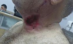 Diyarbakır'da Atın Saldırısına Uğrayan Kişi Ağır Yaralandı