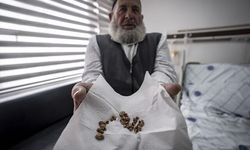 Erzurum'da 2 Çocuk Annesinin Üreterinden 51 Taş Çıkarıldı