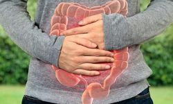 İrritabl Bağırsak Sendromunda Düşük FODMAP Diyeti Önerisi