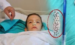 Kahramanmaraş'ta 12 Yaşındaki Çocuğun Ağzından Dev Polip Çıkarıldı