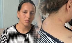 Mersin'de Eşine 17 Bıçak Darbesiyle Saldıran Şüpheli, Ölü Numara Yapan Kadını Yaraladı