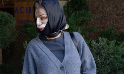 Nadia Almada'nın Türkiye'deki Estetik Operasyonu Gündemde