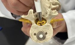 Spinal Stenoz: Bel Fıtığıyla Karışabilen Omurga Daralması