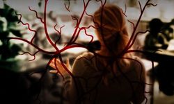 Varis Hastalığında Yanlış Bilinenler: 40 Yıllık Ağrılar Modern Tedaviyle Son Buldu