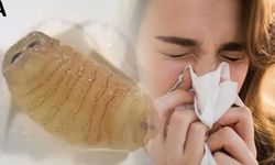 Yunanistan'da Hapşırıkla Burnundan Çıkan Larva Vakası