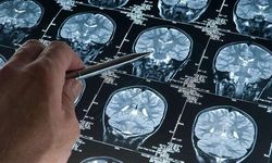 Alzheimer Hastalığında Erken Dönem: Biyobelirteçlerle Teşhis Mümkün Mü?