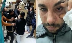 Hatay'da Doktor-Hasta Arasında Yaşanan Kavga Görme Kaybına Yol Açtı
