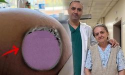 İstanbul'da 62 Yaşındaki Kadının Karnından 22 Kiloluk Tümör Çıktı