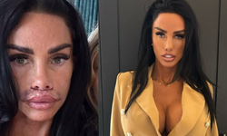 Katie Price Dudak Dolgusu Operasyonunun Ardından Şişliklerini Paylaştı