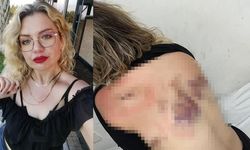 Antalya'da Eski Sevgilinin Bıçaklı Saldırısından Kurtulan Kadının Yaşadıkları