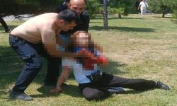 Çatalca'da Boşanma Aşamasındaki Kadına Bıçaklı Saldırı