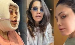 Didem Ceran'ın Revizyon Ameliyatı ve Son Durumu