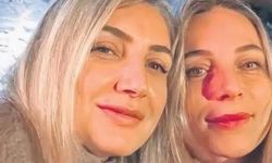 Dilek İmamoğlu'nun Yeğeni Derya Dağdeviren Serbest Bırakıldı