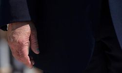 Donald Trump'ın Morlukları Makyajla Gizlenince Tartışma Yarattı