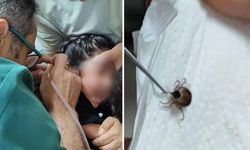 Eskişehir'de Kulak Ağrısı Şikayetiyle Gitti, Kulağından Canlı Kene Çıkarıldı