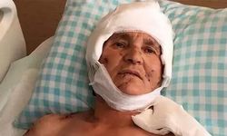 Kırşehir'de Köpek Saldırısı Sonrası Yüzde 37 Engelli Kalan Kadına Yargıtay'dan Tazminat Onayı