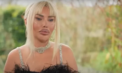 Pınar Özkurteller Azerbaycan'da Göz Rengi Değiştirme Ameliyatı Yaptırdı