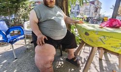 Yürüyebilmek İçin 82 Kilo Vermesi Gereken Kişinin Mücadelesi