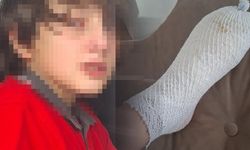 Ankara'da oyuncak patladı, 11 yaşındaki Furkan'ın ayağında 2'nci derece yanık oluştu