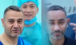 Vietnam'da yüz gençleştirme ameliyatı geçiren Türk vatandaşının değişimi sosyal medyada tartışma yarattı