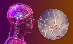 Yüksek Radyasyon Beyinde Alzheimer Riskini Artıran Zincirleme Reaksiyonları Tetikliyor