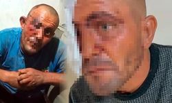 Adana'da sosyal medyada tanınan zihinsel engelli Selçuk Demir darbedildi