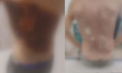 İstanbul Arnavutköy'de 12 yaşındaki çocuğa kolonya döküp ateşe verdiler