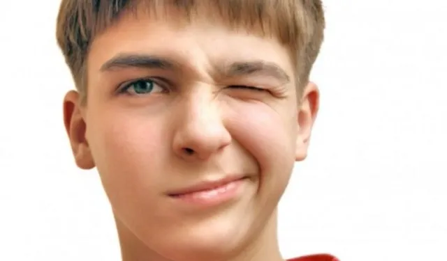 Tourette Sendromu Nedir? Belirtileri nelerdir?