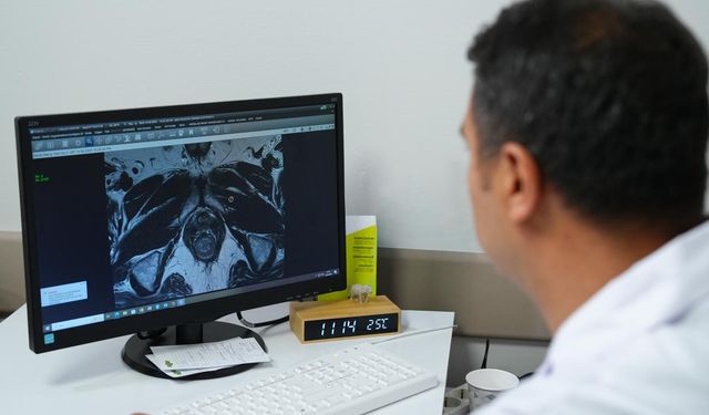 Prostat kanserinde erken ve doğru tanı için "Füzyon biyopsi" dönemi